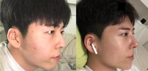 整形爆料视频下载,揭秘网红整形背后的真相